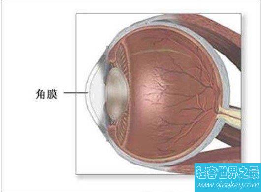 世界第一例人工干细胞培养眼角膜移植成功，40岁女性恢复视力