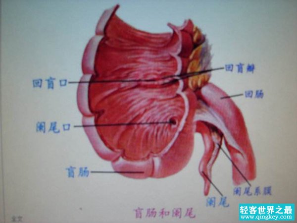 阑尾一定要割掉吗?阑尾切除的坏处