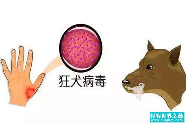 狂犬病是什么?狂犬病能治愈吗(100%死亡)