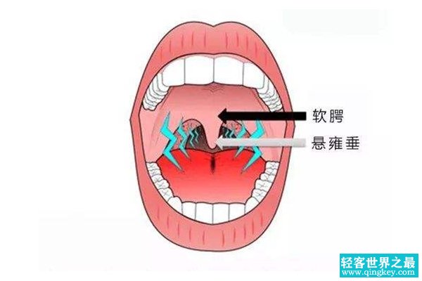 人的小舌有什么用?防止食物和液体倒流鼻腔(食道的小门)