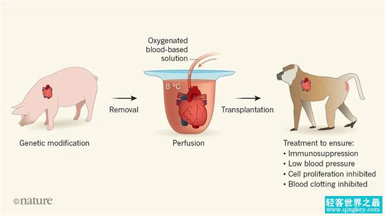 美国成功地将猪的心脏移植到人体 为什么要选择猪心呢？